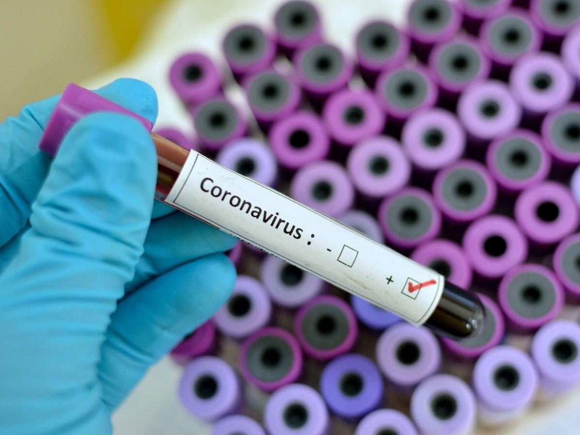 آنچه باید درباره ویروس کرونا بدانید