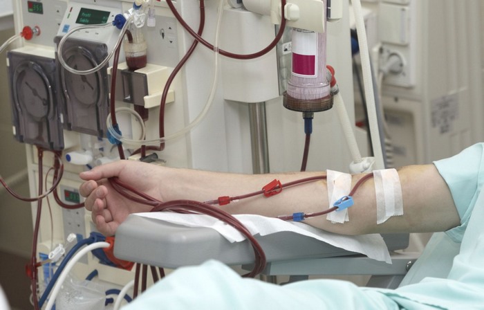 ۱۳ دستگاه دیالیز به بیمارستان مهاباد تخصیص یافت